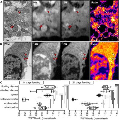 Age-dependent structural reorganization of utricular ribbon synapses